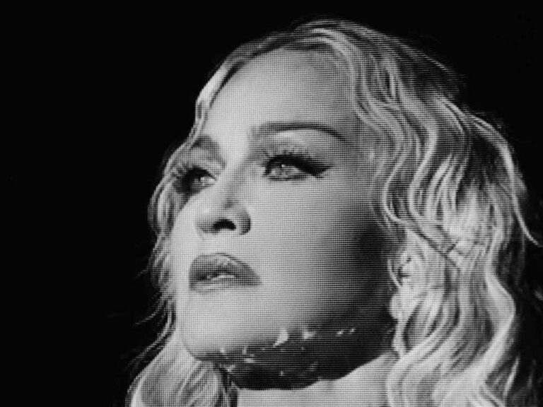 “Concern” for Madonna’s face is often cleverly disguised sexism and ageism